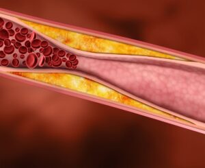 Gezond cholesterolgehalte